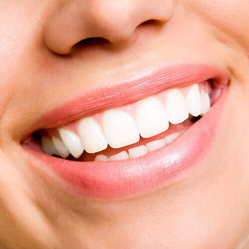 Teeth whitening solutions in Rochdale